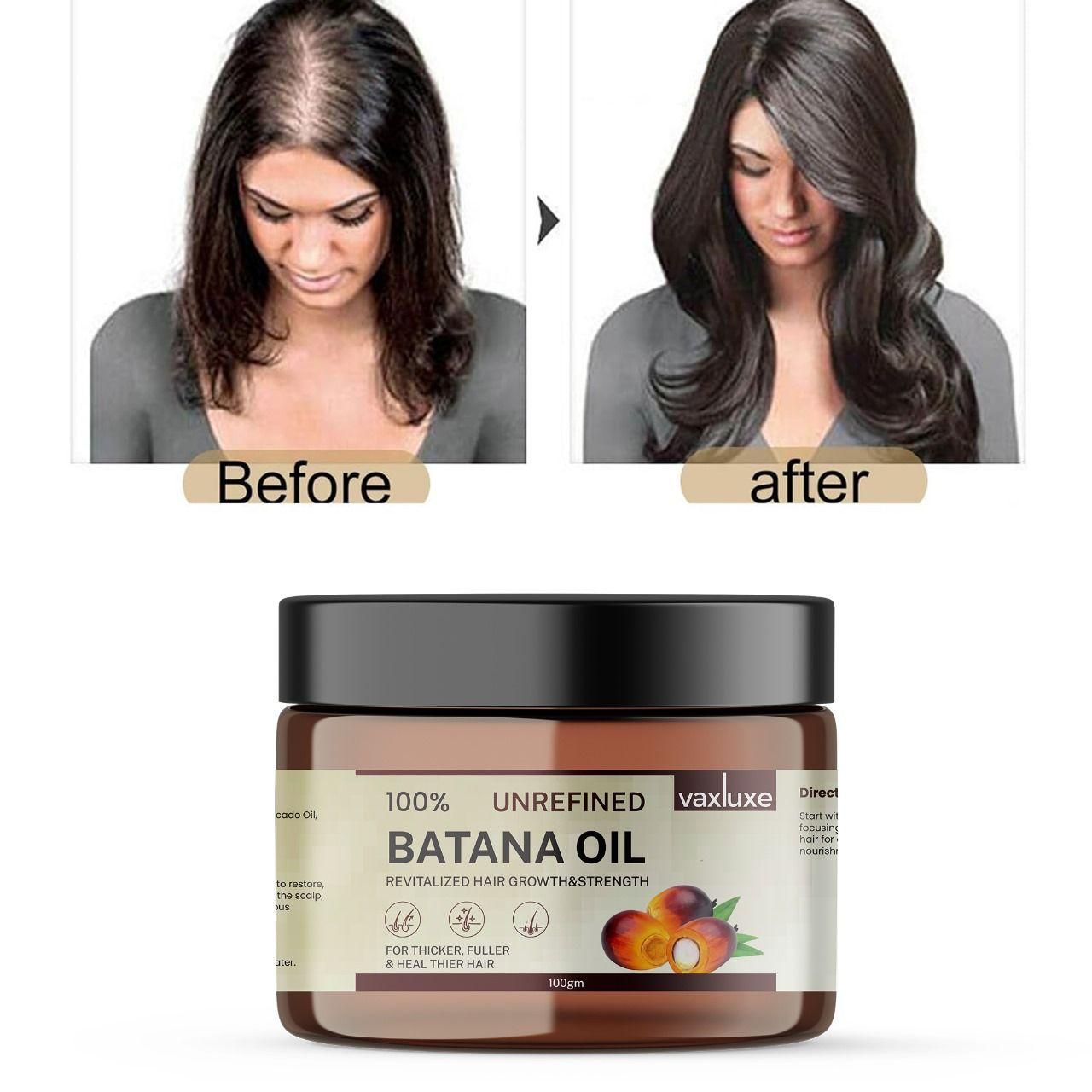 Batana Oil - Hair Growth & Strength (100gm) Pack Of 1