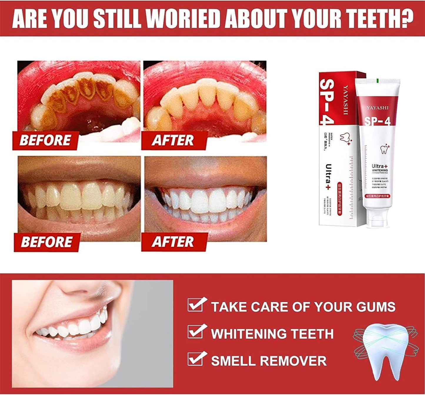 Probiotic Whitening Toothpaste