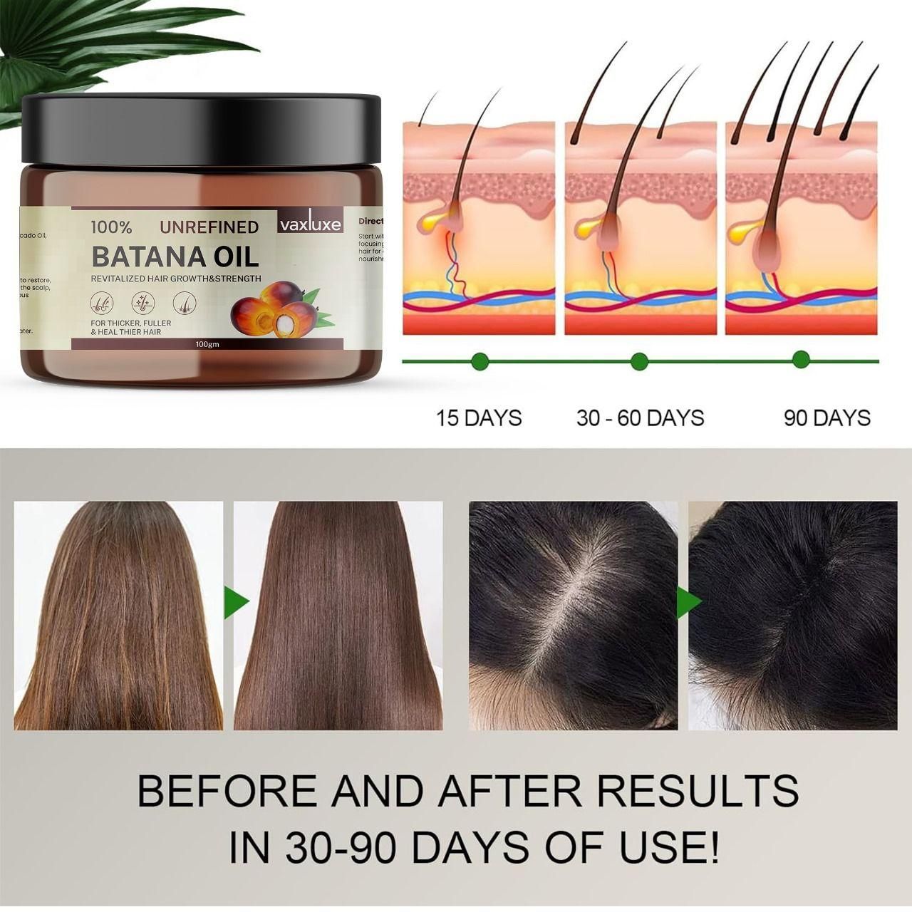 Batana Oil - Hair Growth & Strength (100gm) Pack Of 1