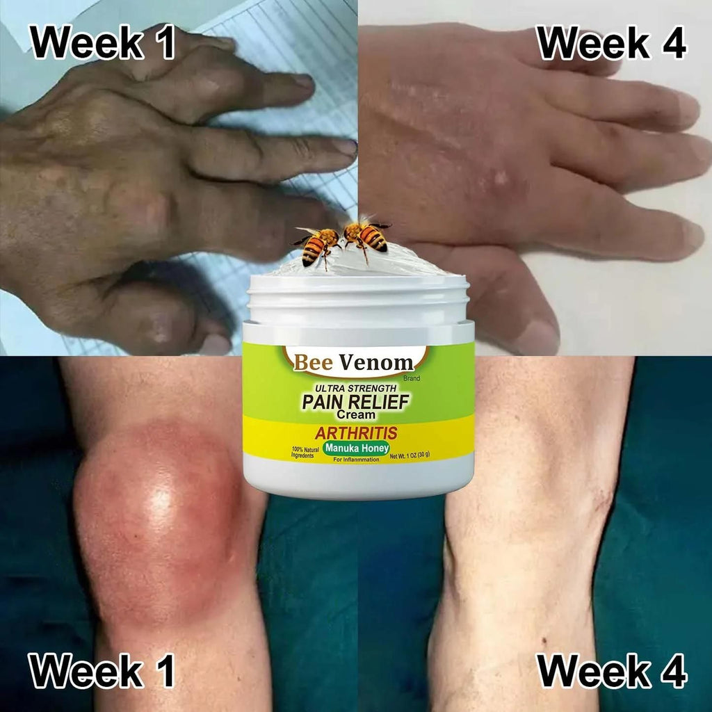 Bee Venom Joint and Bone Therapy Cream (Pack of 3)
