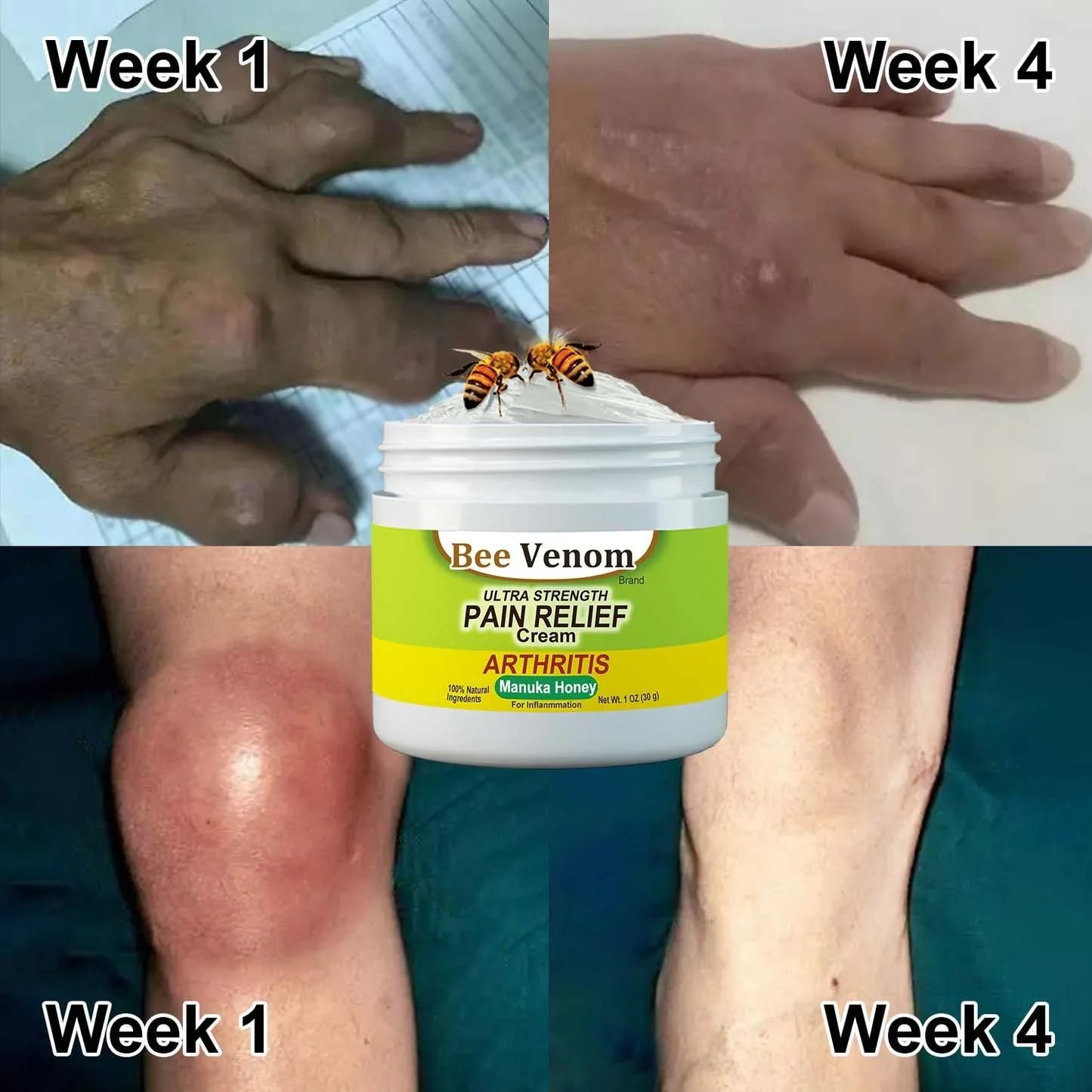 Bee Venom Joint and Bone Therapy Cream (Pack of 3)