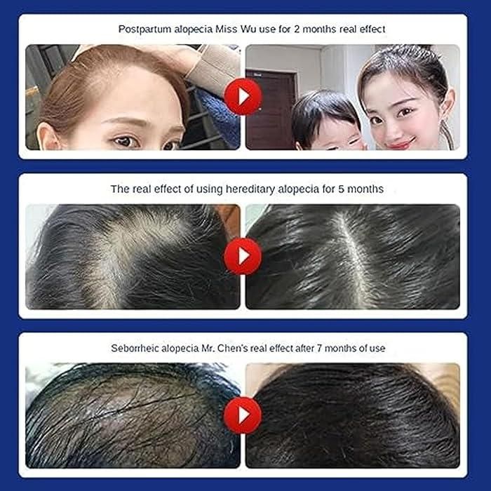 Anti Hair Loss Shampoo 200ML