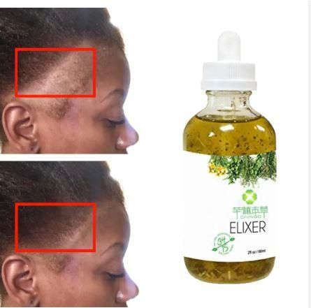 Hair Growth Oil Serum - Hair Loss Treatment (60ml) Pack of 1