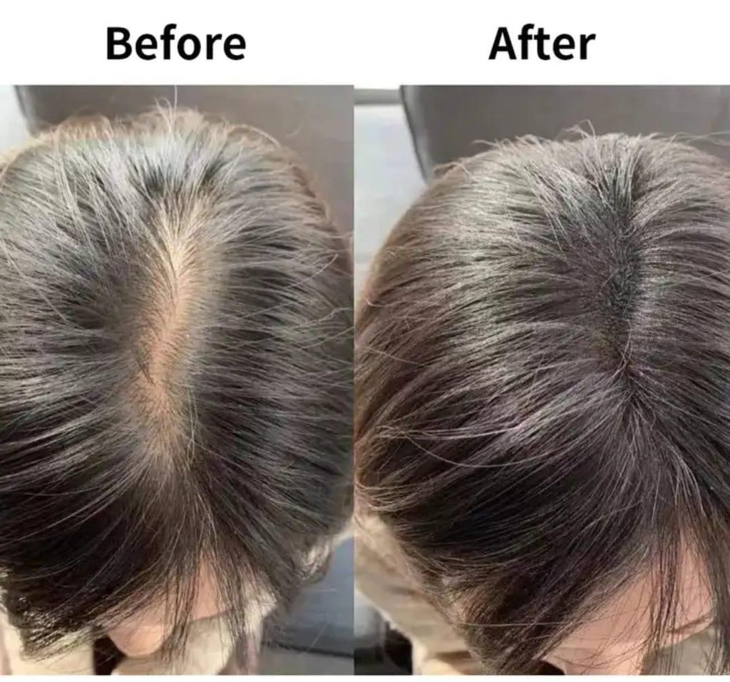 Ginger Hair Growth Shampoo (300ml) Pack of 1