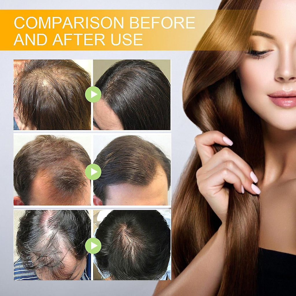 Hair Growth Herbal Serum (30ml) Pack of 2