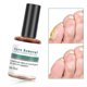 Feet Corn Removal Serum -30 ml